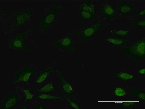 Anti-PSMB7 antibody produced in mouse purified immunoglobulin, buffered aqueous solution