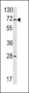 ANTI-USP21 (CENTER) antibody produced in rabbit IgG fraction of antiserum, buffered aqueous solution