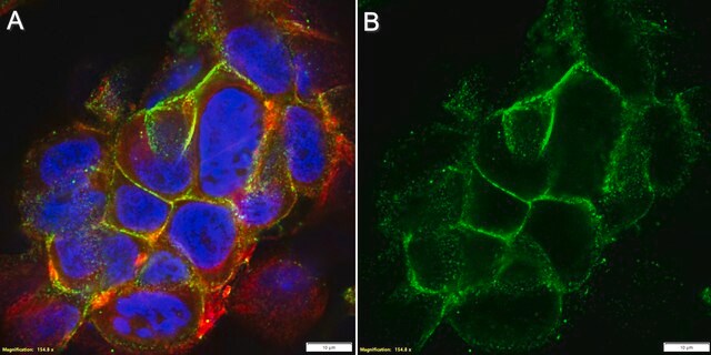 Anti-E-Cadherin/CD324 Antibody, clone 19A11