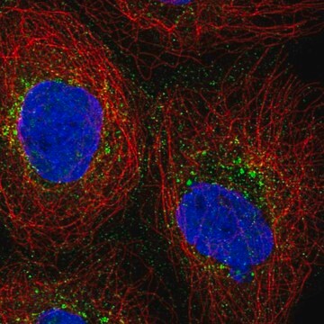 Anti-PRPS2 antibody produced in rabbit Prestige Antibodies&#174; Powered by Atlas Antibodies, affinity isolated antibody