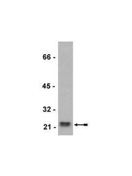 Anticorpo anti-Rho (-A, -B, -C), clone 55 clone 55, Upstate&#174;, from mouse