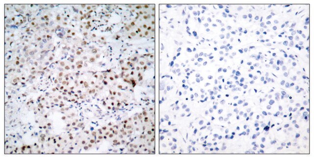 Anti-CREB antibody produced in rabbit affinity isolated antibody