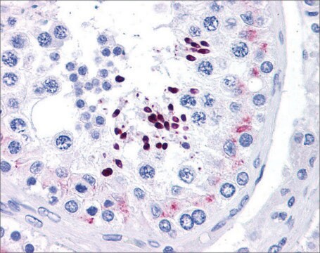 Anti-CCND1 (ab3) antibody produced in rabbit affinity isolated antibody