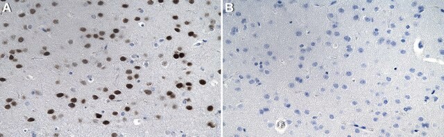 Anti-Tbr1 Antibody from rabbit, purified by affinity chromatography