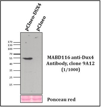 Anticorpo anti-Dux4, clone 9A12 clone 9A12, from mouse