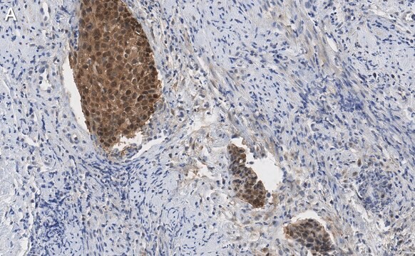 抗p16-INK4a抗体 クローン5F22抗体 ZooMAb&#174;ウサギ・モノクローナル recombinant, expressed in HEK 293 cells