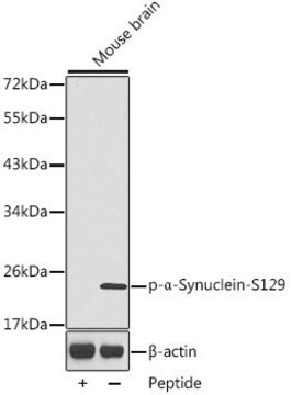 Anti-Phospho-&#945;-Synuclein-S129 antibody produced in rabbit