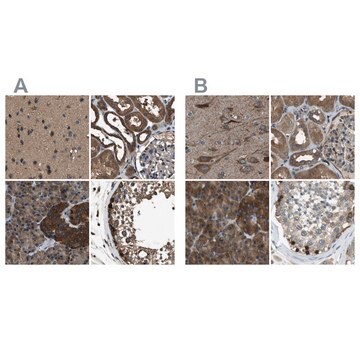 Anti-ARFGAP2 antibody produced in rabbit Prestige Antibodies&#174; Powered by Atlas Antibodies, affinity isolated antibody, buffered aqueous glycerol solution