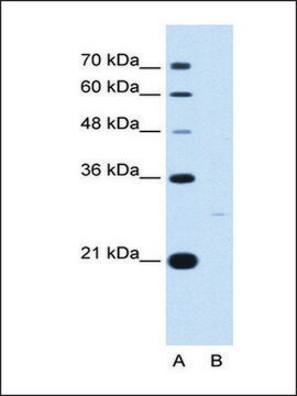 Anti-YWHAZ antibody produced in rabbit IgG fraction of antiserum