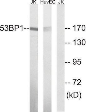 Anti-53BP1 antibody produced in rabbit affinity isolated antibody