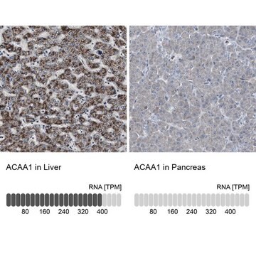 抗ACAA1抗体 ウサギ宿主抗体 Ab2, Prestige Antibodies&#174; Powered by Atlas Antibodies, affinity isolated antibody, buffered aqueous glycerol solution