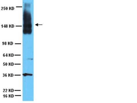 Anti-neurales Zelladhäsionsmolekül-Antikörper Chemicon&#174;, from rabbit