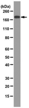 Anti-Angiotensin Converting Enzyme Antibody, clone 2E2 culture supernatant, clone 2E2, from mouse