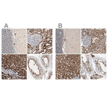 抗ACAT1抗体 ウサギ宿主抗体 Ab1, Prestige Antibodies&#174; Powered by Atlas Antibodies, affinity isolated antibody, buffered aqueous glycerol solution