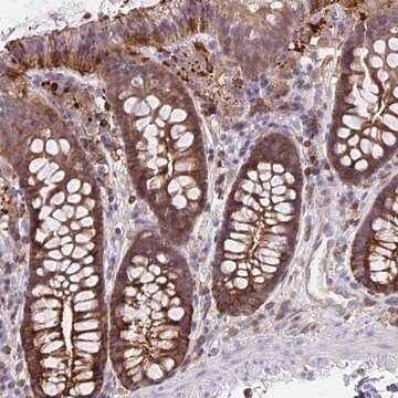 Anty-CFL1 Prestige Antibodies&#174; Powered by Atlas Antibodies, affinity isolated antibody, buffered aqueous glycerol solution