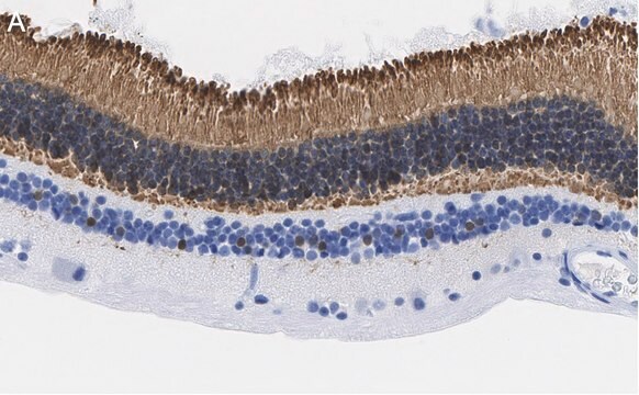 抗リカバリン抗体 クローン1K10 ZooMAb&#174;ウサギ・モノクローナル recombinant, expressed in HEK 293 cells