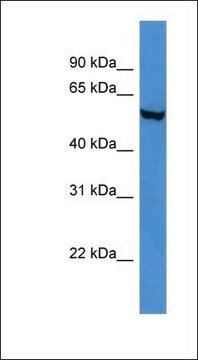 Anti-FTO antibody produced in rabbit affinity isolated antibody