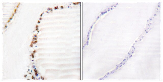 Anti-Cullin 3 antibody produced in rabbit affinity isolated antibody