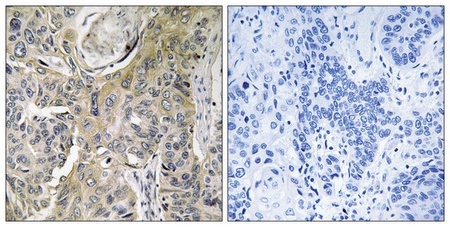 Anti-RHOBTB3 antibody produced in rabbit affinity isolated antibody