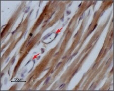 Anti-Sodium Channel NaV1.5 antibody produced in rabbit affinity isolated antibody, lyophilized powder