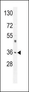 ANTI-M6PR(C-TERMINAL) antibody produced in rabbit purified immunoglobulin, buffered aqueous solution