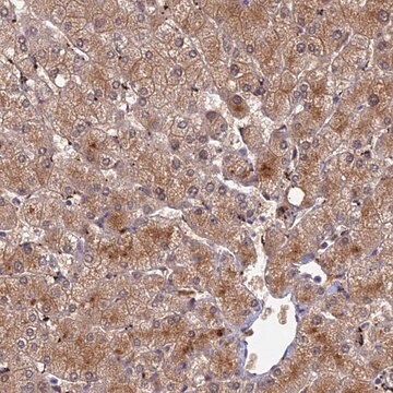 Anti-ADAMTS13 antibody produced in rabbit Prestige Antibodies&#174; Powered by Atlas Antibodies, affinity isolated antibody, buffered aqueous glycerol solution