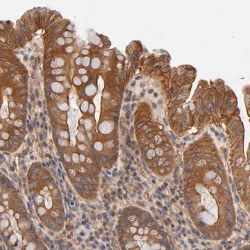 Anti-LAMTOR2 antibody produced in rabbit Prestige Antibodies&#174; Powered by Atlas Antibodies, affinity isolated antibody, buffered aqueous glycerol solution