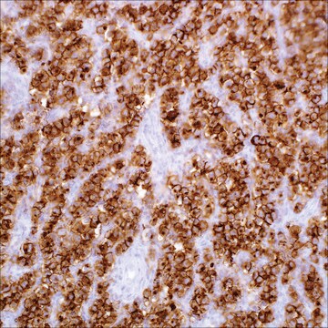 PLAP (NB10) Mouse Monoclonal Antibody