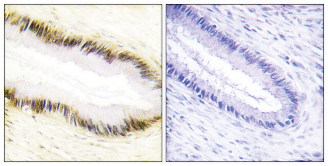 Anti-NR2F6 antibody produced in rabbit affinity isolated antibody