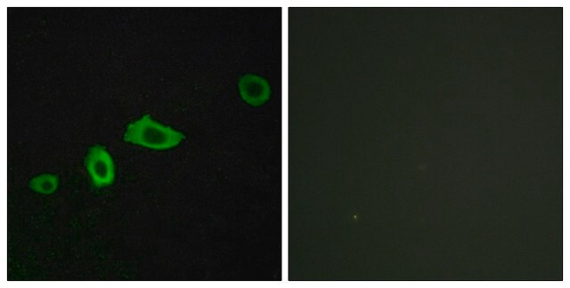 Anti-HTR5A antibody produced in rabbit affinity isolated antibody