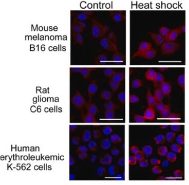 Anti-DNAJB1/Hdj1 Antibody, clone J25 clone J25, from mouse