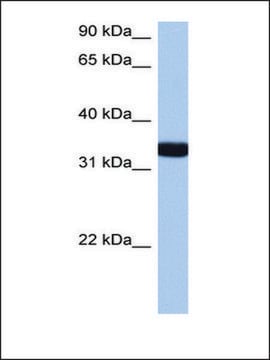 Anti-GIMAP1 antibody produced in rabbit affinity isolated antibody