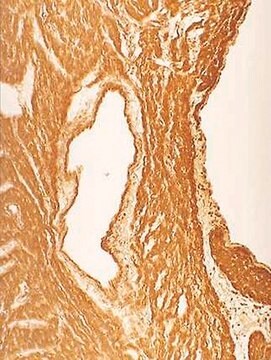 Anticuerpo anti-nitrotirosina, clon 1A6 clone 1A6, Upstate&#174;, from mouse