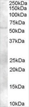 Anti-FAZF/TZFP/ZBTB32 antibody produced in goat affinity isolated antibody, buffered aqueous solution