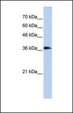 抗-ATP6V0D2 兔抗 affinity isolated antibody