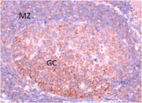 Anti-Fbxo7 Antibody